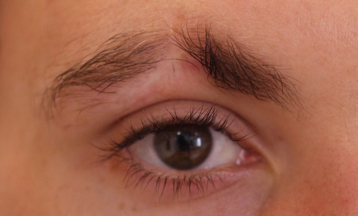 EYEBROW SLITS RISKS