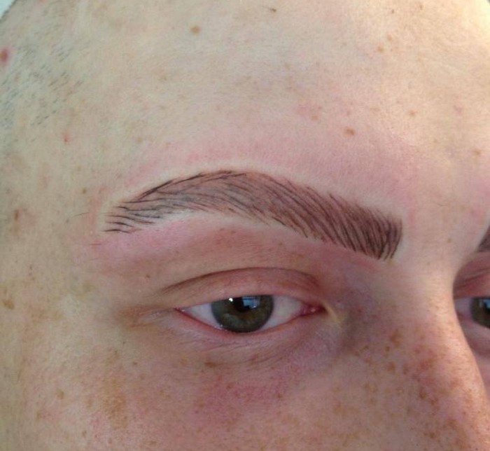 why do my eyebrows itch after salon treatments