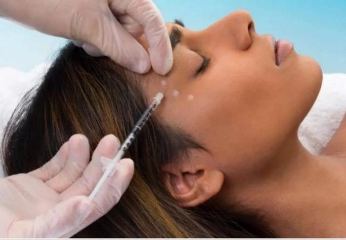 Brow lift with thread and Botox