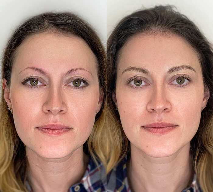 Can eyebrow hair grow back?