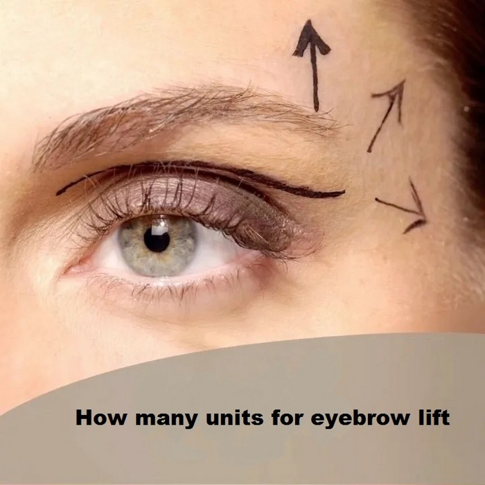 How many units for eyebrow lift?