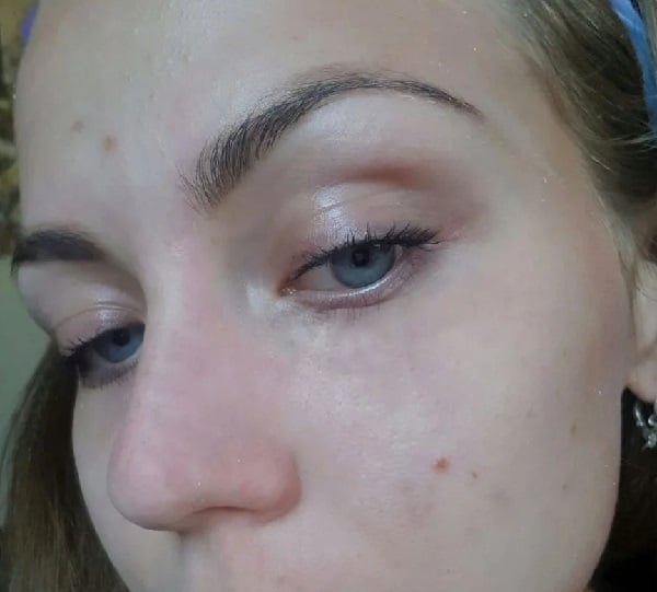 How to fix one eyebrow higher than the other botox?