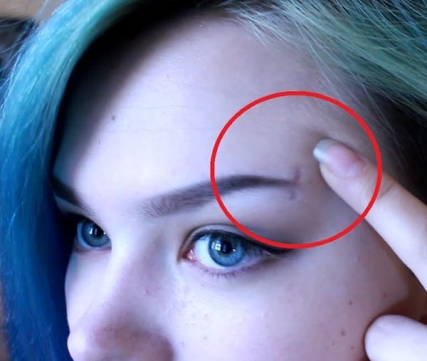 eyebrow-piercing-infection