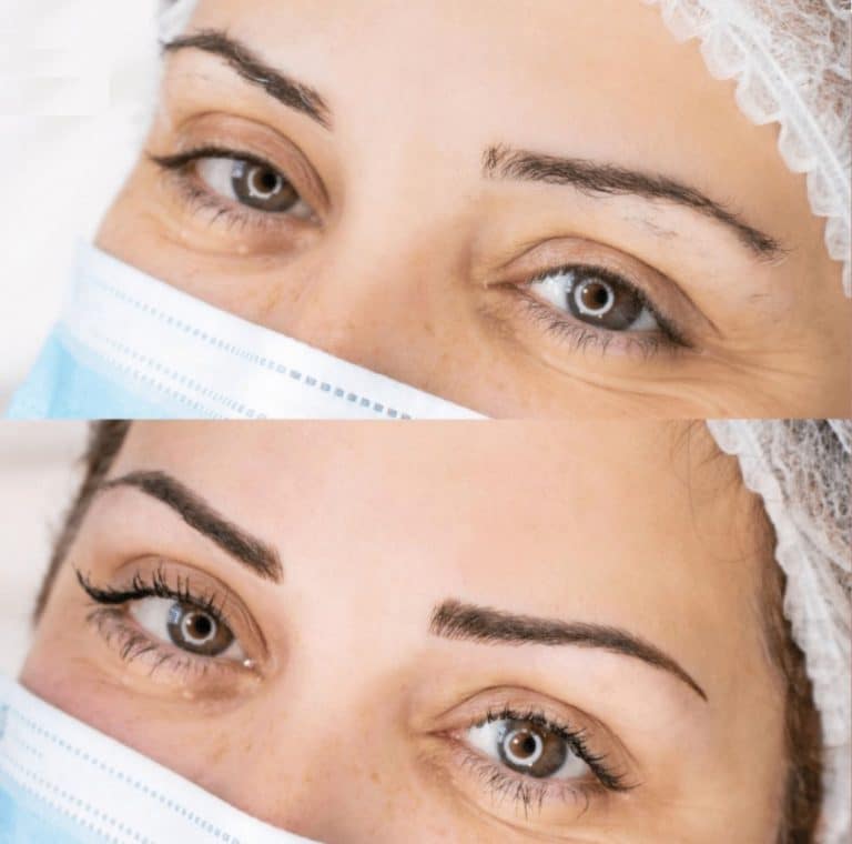 Do you have thinning eyebrows? Here's a DEFINITIVE remedy [WITH PHOTOS].