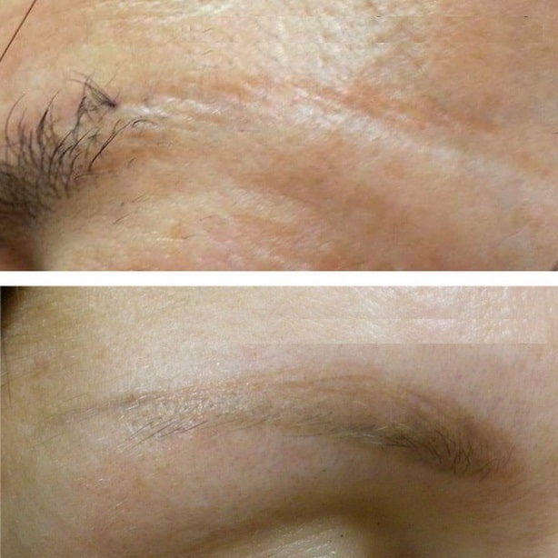 Microblading faded? Here's what you need to do