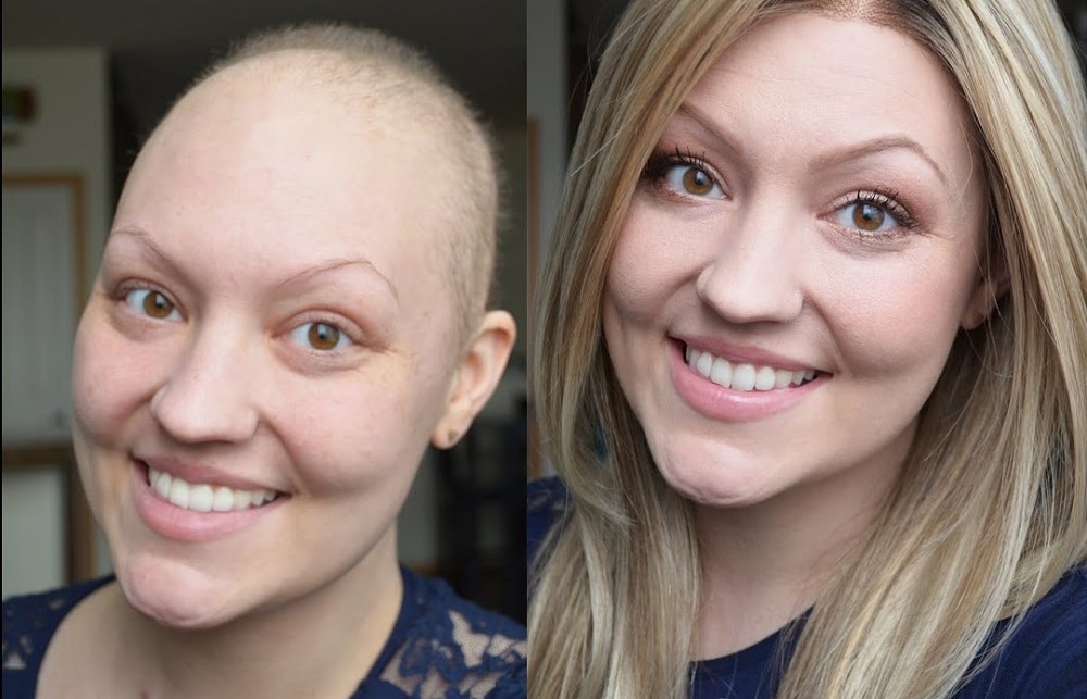 After Cycles Of Chemo After How Long Do Eyelashes And Eyebrows Grow Back?